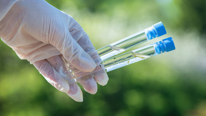 What You Need to Know About Chromium-6